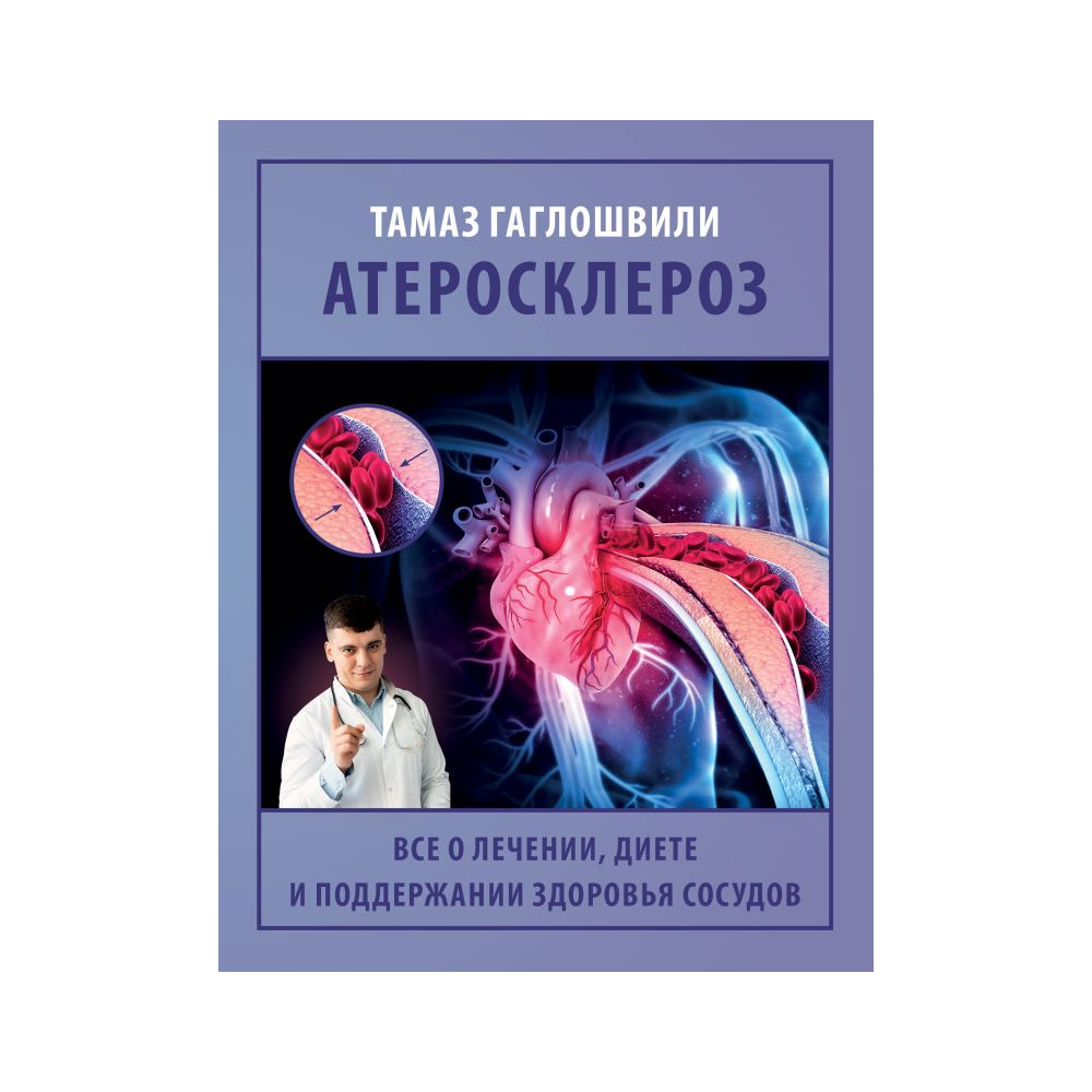 Атеросклероз. Все о лечении, диете и поддержании здоровья сосудов